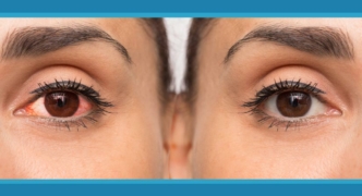 5 Dangerous Misconceptions About Eye Injuries Header